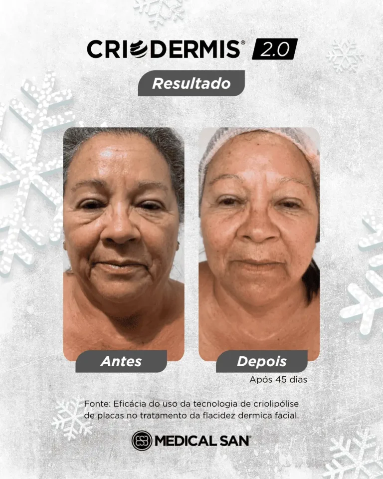 oohlocacao-provasocial-2