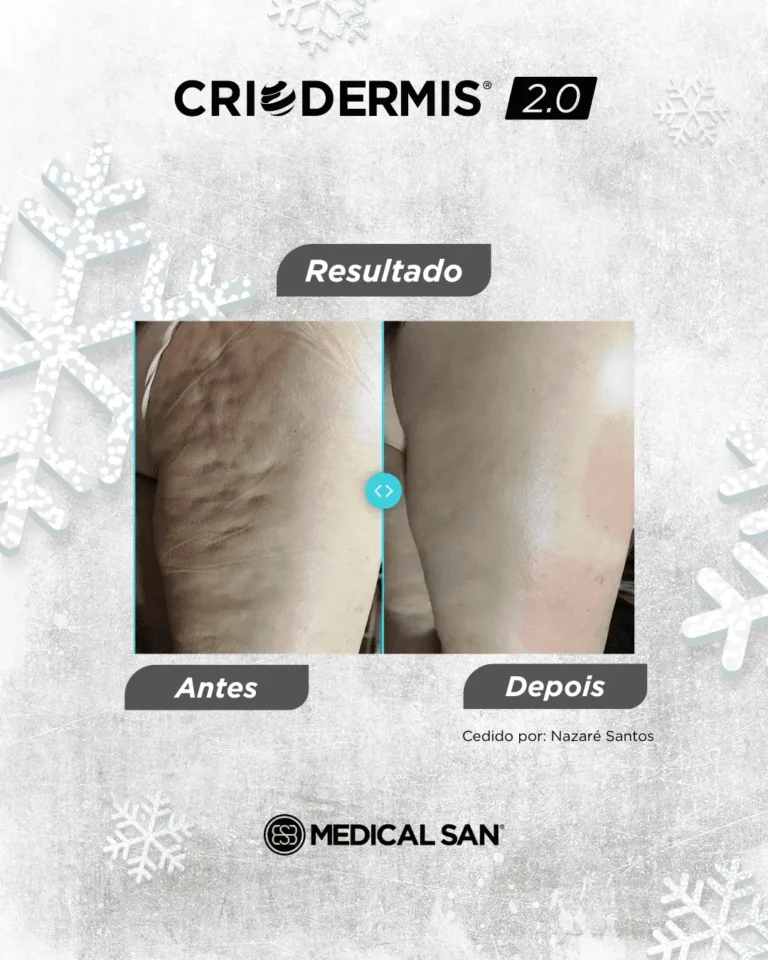 oohlocacao-provasocial-4