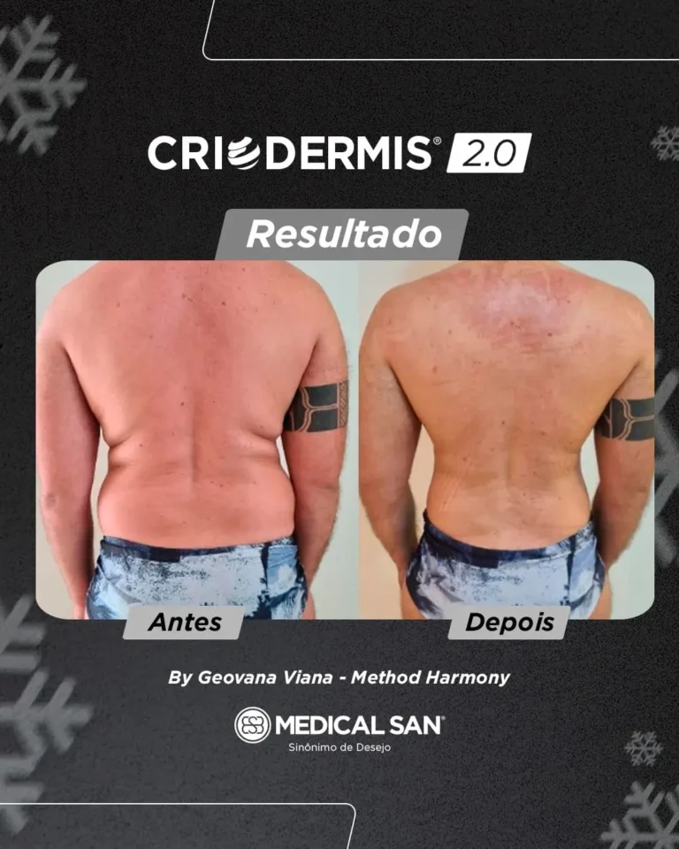 oohlocacao-provasocial-5