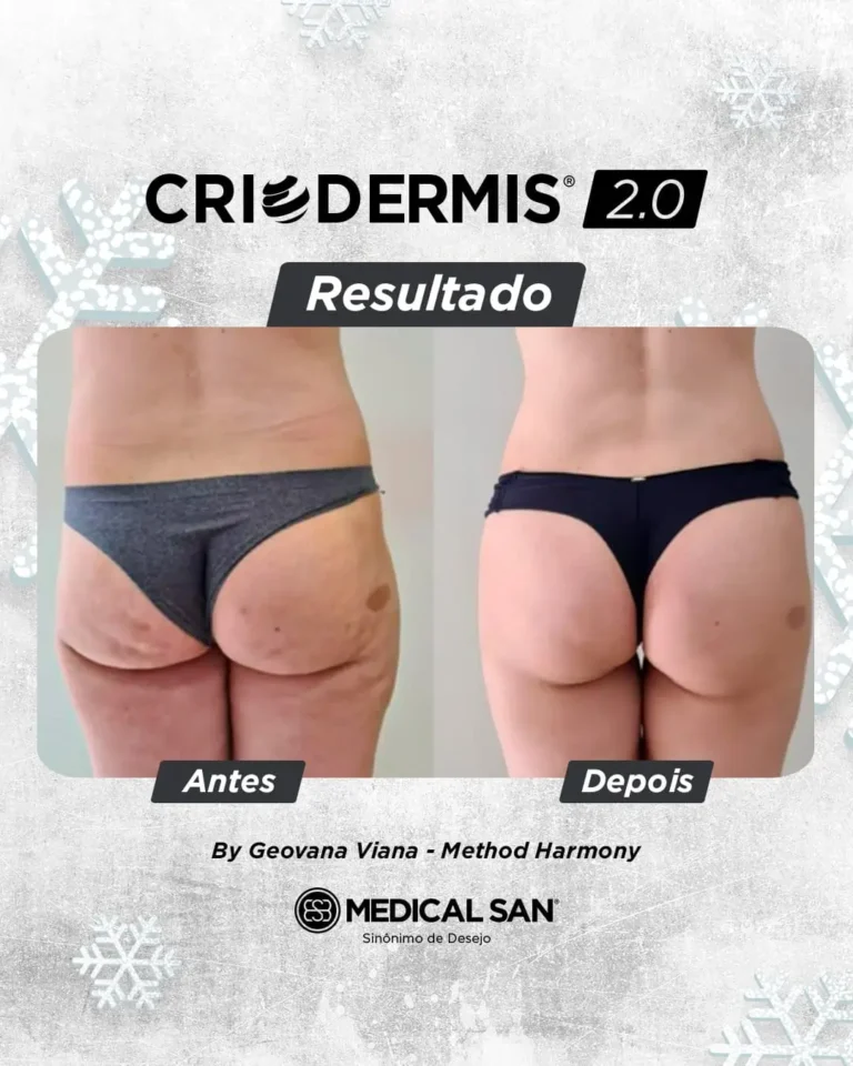 oohlocacao-provasocial-6