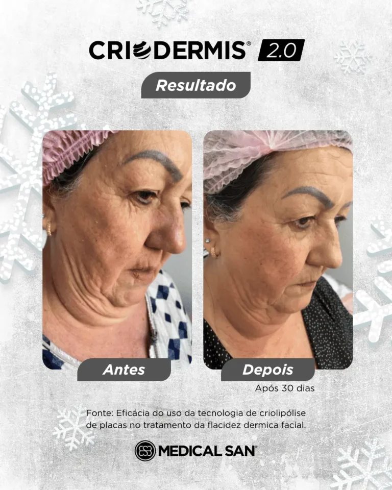 oohlocacao-provasocial-8